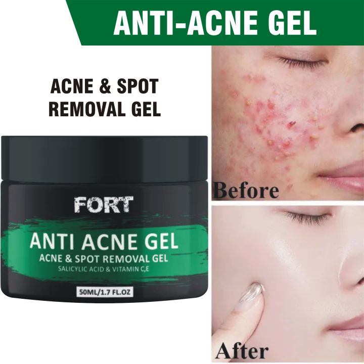 Fort Anti Acne Gel For Acne & Spot Removal With Salicylic Acid & Vitamin C,E | Anti Acne Face Treatment Gel | 50ml