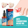 Anti Paronychia Relief Oil Ingrown Toenail Drops Anti Fungal Toe Nail Ingrown Corrector Stop Pain Onychomycosis Treatment Serum. 