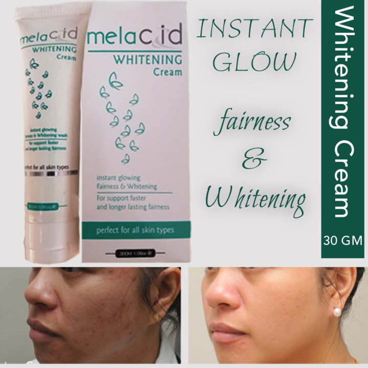Melacid%20Whitening%20Cream%20Instant%20Fairness%20-%20Results%20in%202%20week%20-%20Image%202