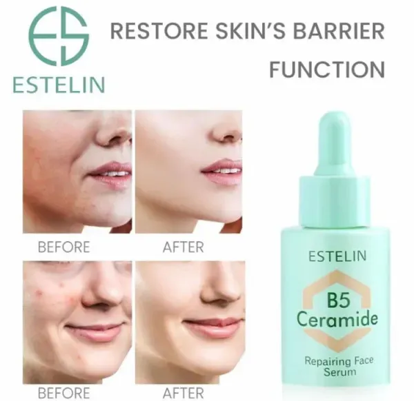 ESTELIN Ceramide B5 Repairing Face Serum 30ml ES0087 | Daraz.pk