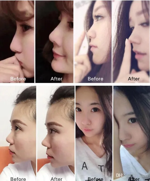 Nose%20Up%20Lifting%20Shaping%20Clip%20Tool%20-%203%20Sizes%20with%20Medical-Grade%20Silicone%20-%20Image%205