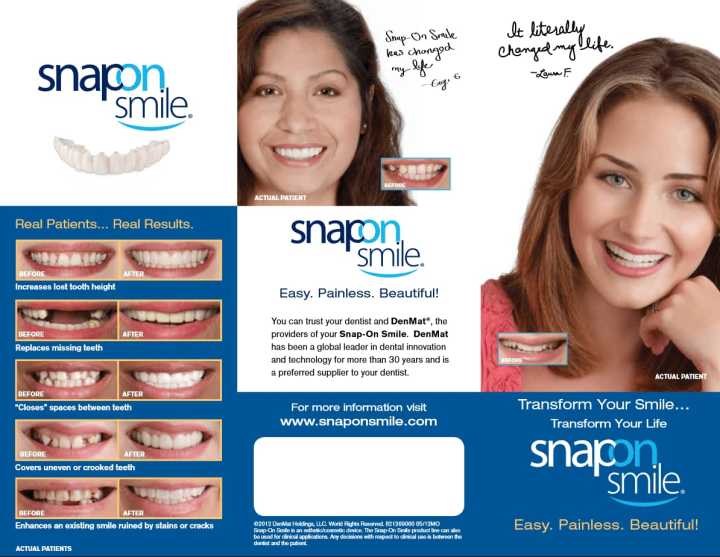 Perfect Fit Snap-On Smile Veneers – Upper & Lower Natural Look Teeth Covers & Braces