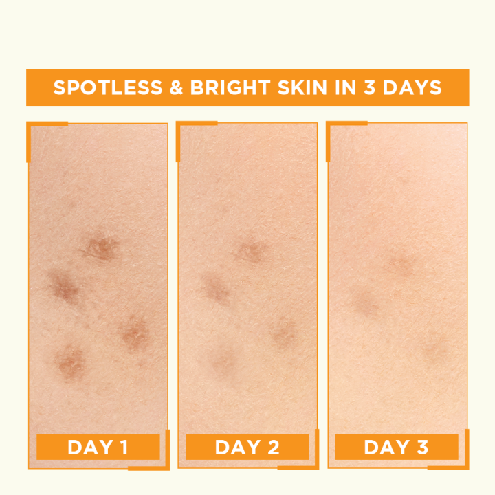 Garnier%20Skin%20Active%20Bright%20Complete%20Vitamin%20C%20Booster%20Serum%2015%20ML%20-%20Contains%20Niacinamide%20-%20Image%204