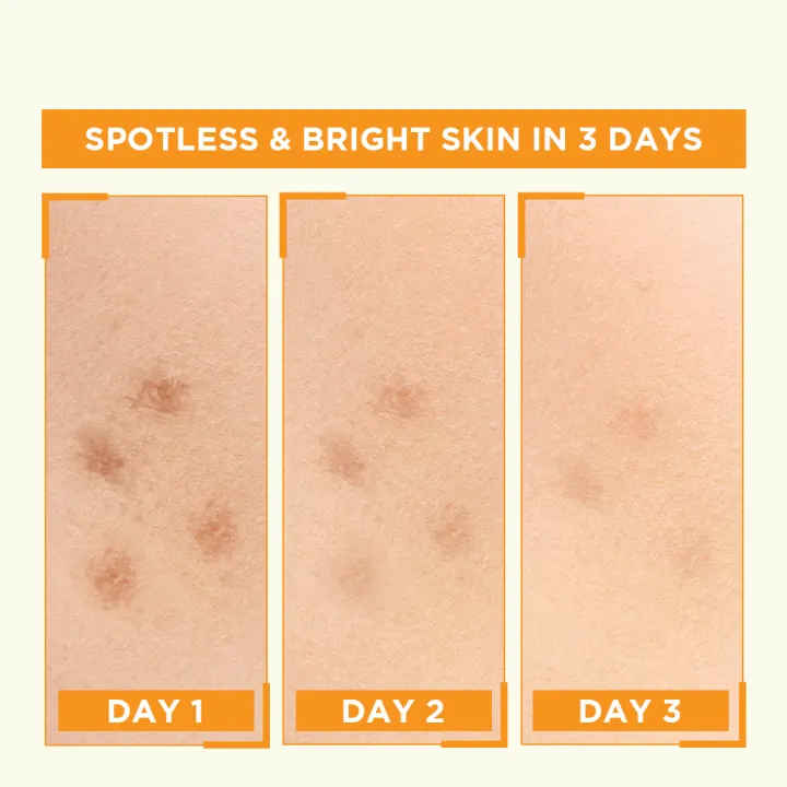 Garnier%20Skin%20Active%20Bright%20Complete%20Vitamin%20C%20Booster%20Serum%2015%20ML%20-%20Contains%20Niacinamide%20-%20Image%204
