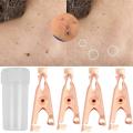 Small Clip Copper Tag Remover Skin Care Wart Remover Micro Strip Cleaning Skin Tag Removal Kit Facial Beauty Makeup Tools 1/2pcs. 