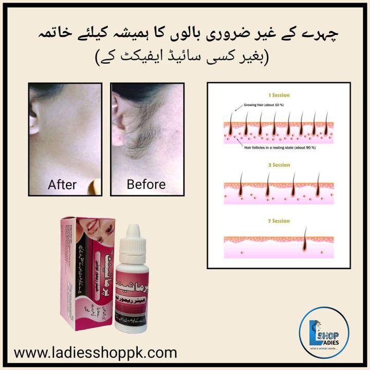Pack Of 3 Permanent Facial Hair Remover Lotion