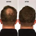 Refill Toppik Hair Fiber Dark Brown 10g. 
