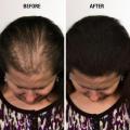 Refill Toppik Hair Fiber Dark Brown 10g. 